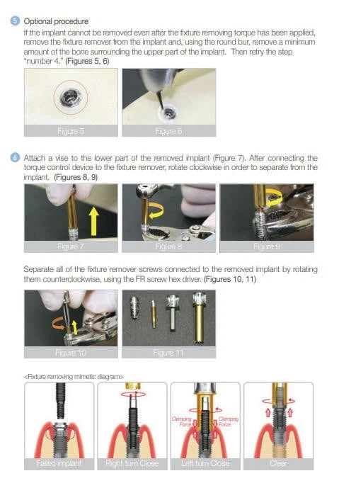 Universal Implant Fixture Removal Kit FR Screw Remover Tool Neobiotech Style