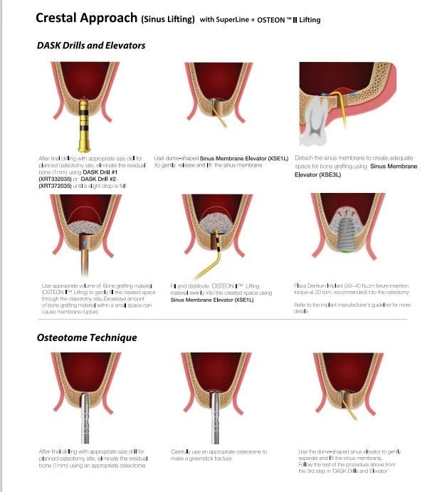 DASK Dental Sinus Lift Kit Lateral Crestal Drills Stoppers Elevation Instruments