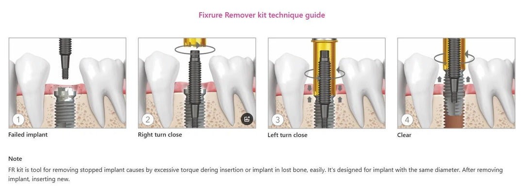 Universal Implant Fixture Removal Kit FR Screw Remover Tool Neobiotech Style
